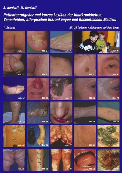 Patientenratgeber und kurzes Lexikon der Hautkrankheiten, Venenleiden, allergischen Erkrankungen und kosmetischen Medizin, Taschenbuch von Maria