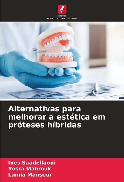 Produktbild: Alternativas para melhorar a est&eacute;tica em pr&oacute;teses h&iacute;bridas