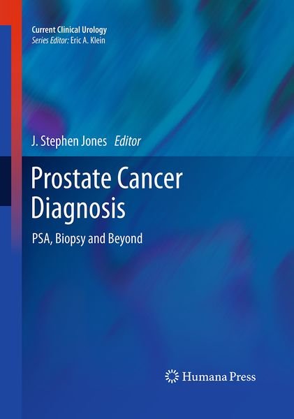Produktbild: Prostate Cancer Diagnosis