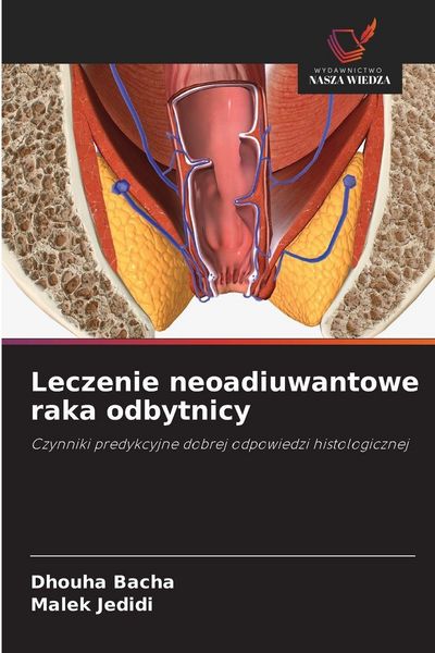 Produktbild: Leczenie neoadiuwantowe raka odbytnicy