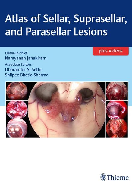 Produktbild: Atlas of Sellar, Suprasellar, and Parasellar Lesions