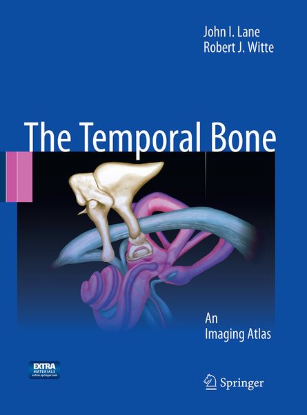Produktbild: Temporal Bone