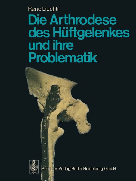 Produktbild: Die Arthrodese des H&uuml;ftgelenkes und ihre Problematik