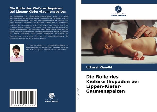 Die Rolle des Kieferorthopäden bei Lippen-Kiefer-Gaumenspalten, Taschenbuch von Utkarsh Gandhi, Verlag Unser Wissen, 9786204394596