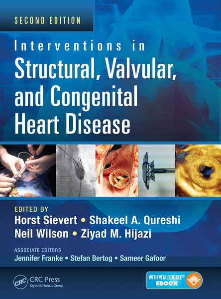 Produktbild: Interventions in Structural, Valvular and Congenital Heart Disease