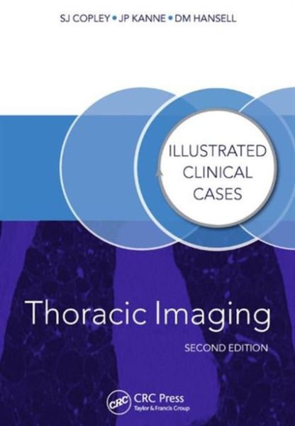 Produktbild: Thoracic Imaging