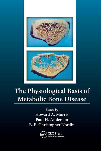 Produktbild: The Physiological Basis of Metabolic Bone Disease