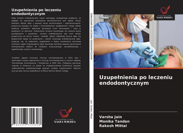 Produktbild: Uzupe&iquest;nienia po leczeniu endodontycznym