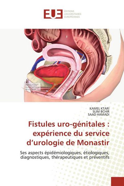 Produktbild: Fistules uro-g&eacute;nitales : exp&eacute;rience du service d'urologie de Monastir