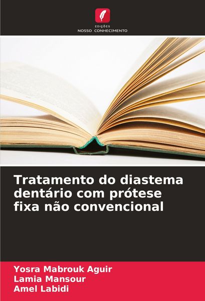 Produktbild: Tratamento do diastema dent&aacute;rio com pr&oacute;tese fixa n&atilde;o convencional