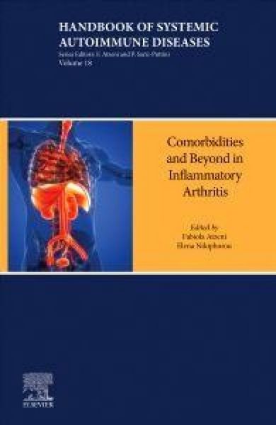 Produktbild: Inflammatory Arthritis Beyond the Joints