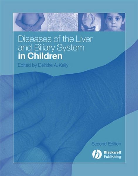 Produktbild: Diseases of the Liver and Biliary System in Children
