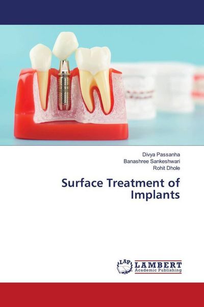 Produktbild: Surface Treatment of Implants