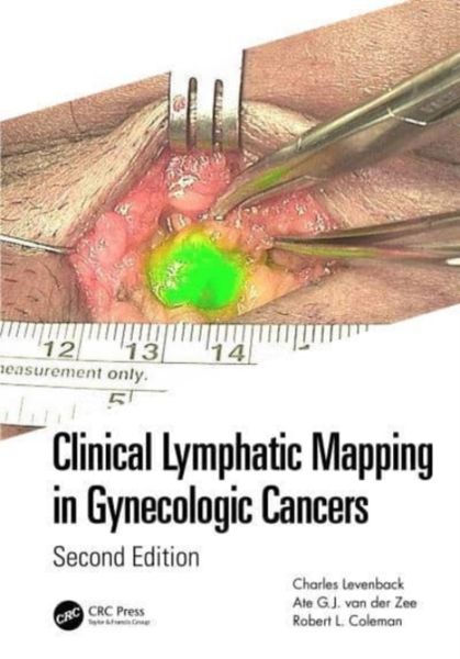 Produktbild: Clinical Lymphatic Mapping in Gynecologic Cancers