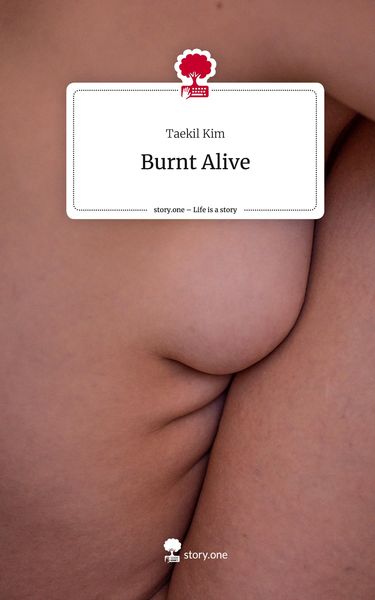 Burnt Alive. Life is a Story - story.one