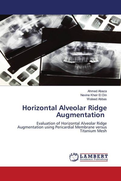 Produktbild: Horizontal Alveolar Ridge Augmentation