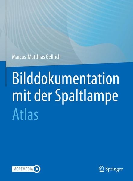 Produktbild: Bilddokumentation mit der Spaltlampe