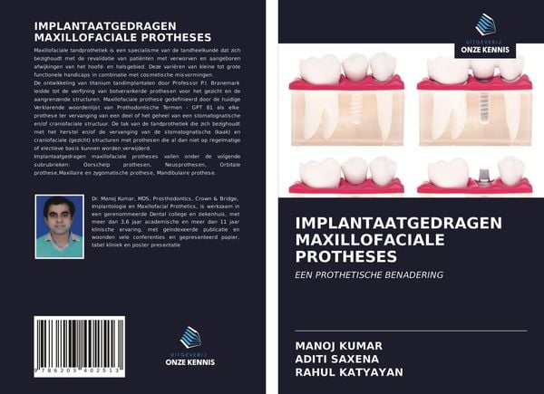 Produktbild: Implantaatgedragen Maxillofaciale Protheses