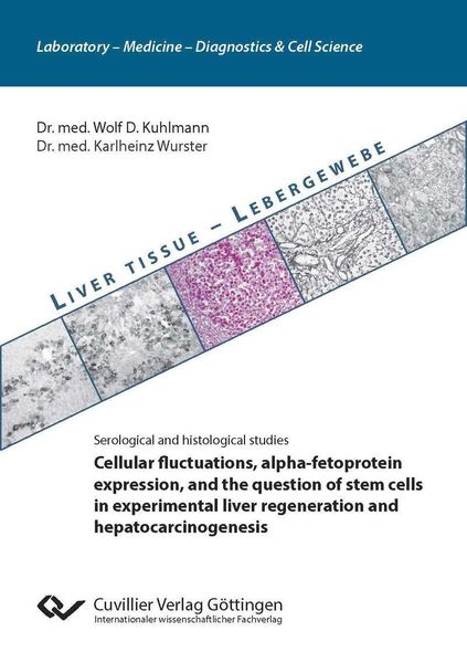 Produktbild: Cellular fluctuations, alpha-fetoprotein expression, and the question of stem cells in experimental liver regeneration and hepatocarcinogenesis