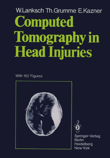 Produktbild: Computed Tomography in Head Injuries