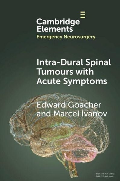 Produktbild: Intra-dural Spinal Tumours with Acute Symptoms