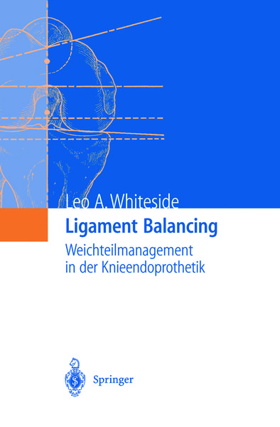 Produktbild: Ligament Balancing