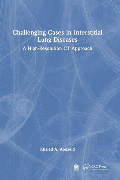 Produktbild: Challenging Cases in Interstitial Lung Diseases