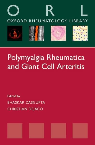 Produktbild: Polymyalgia Rheumatica and Giant Cell Arteritis