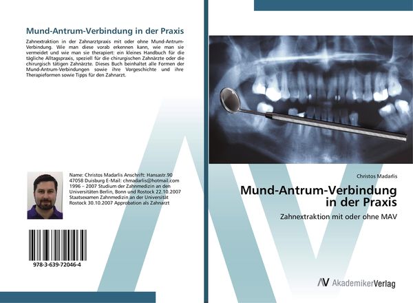 Produktbild: Mund-Antrum-Verbindung in der Praxis