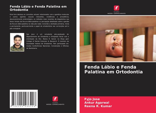 Produktbild: Fenda L&aacute;bio e Fenda Palatina em Ortodontia