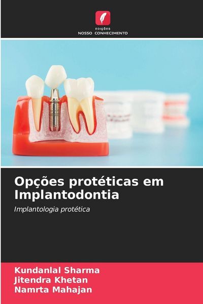 Produktbild: Op&ccedil;&otilde;es prot&eacute;ticas em Implantodontia