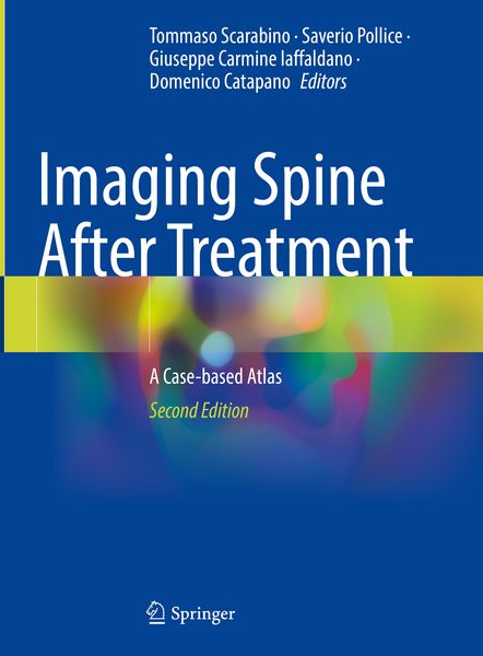Produktbild: Imaging Spine After Treatment