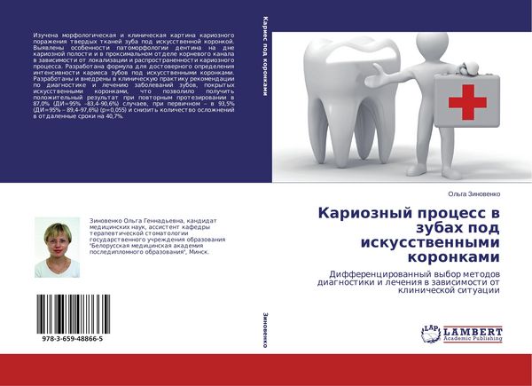 Produktbild: Karioznyj process w zubah pod iskusstwennymi koronkami