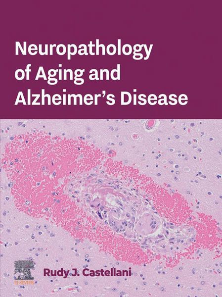 Produktbild: Neuropathology of Aging and Alzheimer's Disease