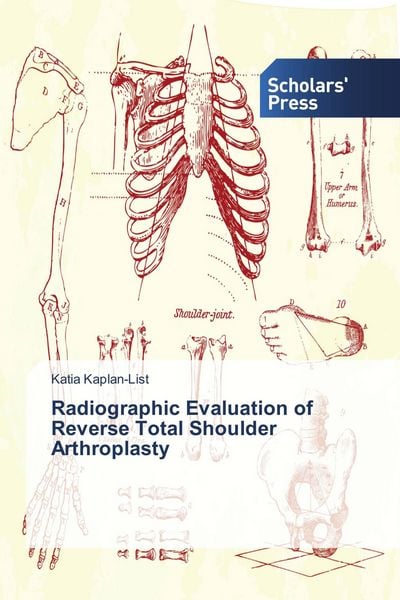 Produktbild: Radiographic Evaluation of Reverse Total Shoulder Arthroplasty