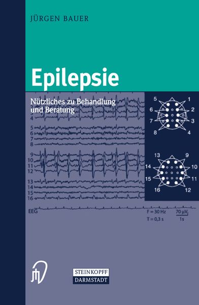 Produktbild: Epilepsie