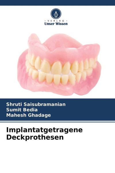Produktbild: Implantatgetragene Deckprothesen