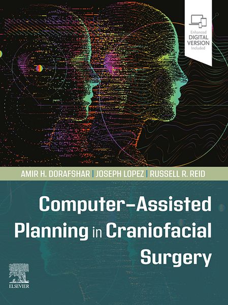 Produktbild: Computer-Assisted Planning in Craniofacial Surgery - E-Book