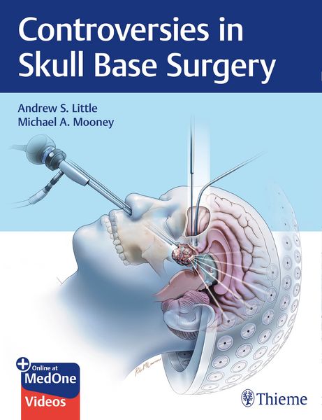 Produktbild: Controversies in Skull Base Surgery