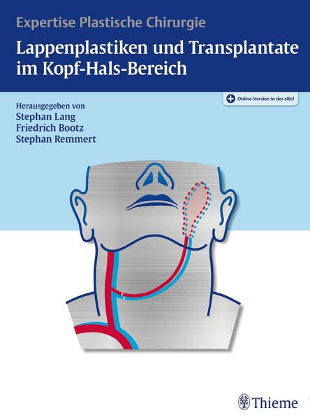 Produktbild: Lappenplastiken und Transplantate im Kopf-Hals-Bereich