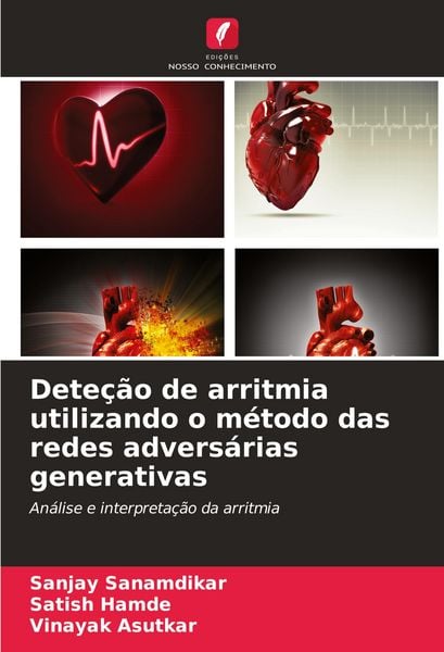 Produktbild: Dete&ccedil;&atilde;o de arritmia utilizando o m&eacute;todo das redes advers&aacute;rias generativas