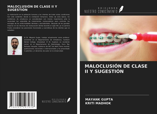 Produktbild: Maloclusi&oacute;n De Clase Ii Y Sugesti&oacute;n
