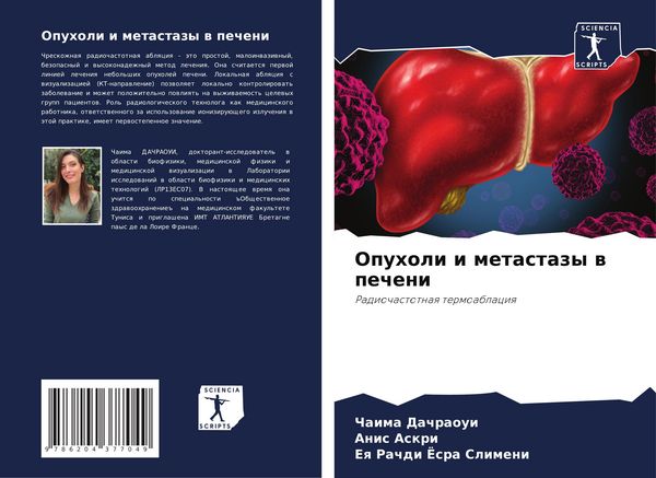 Produktbild: Opuholi i metastazy w pecheni