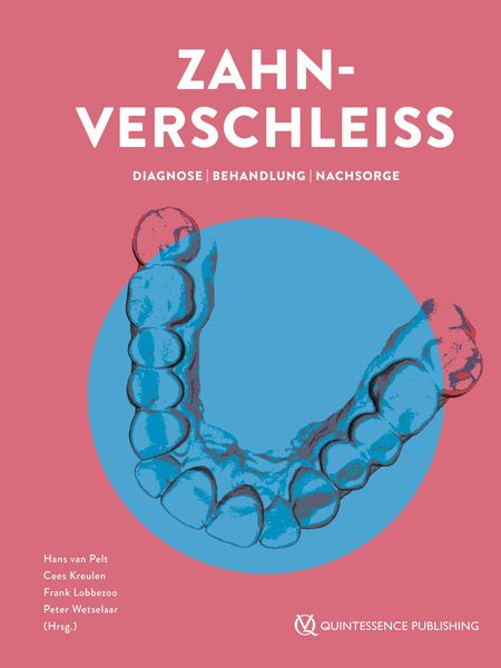 Produktbild: Zahnverschlei&szlig;