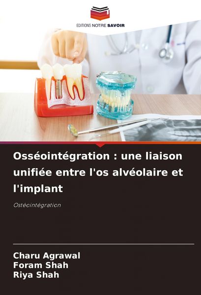 Produktbild: Oss&eacute;oint&eacute;gration : une liaison unifi&eacute;e entre l'os alv&eacute;olaire et l'implant