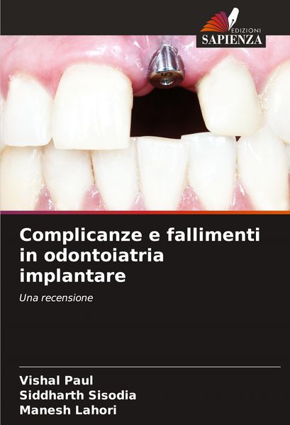 Produktbild: Complicanze e fallimenti in odontoiatria implantare