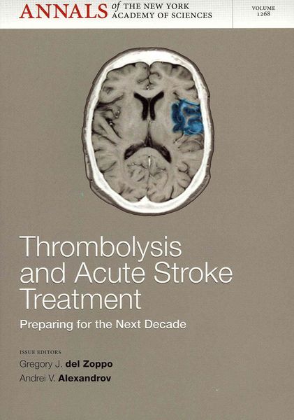 Produktbild: Thrombolysis & Acute Stoke