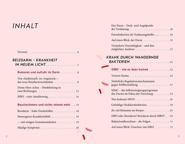 Produktbild: Endlich Heilung f&uuml;r den Reizdarm