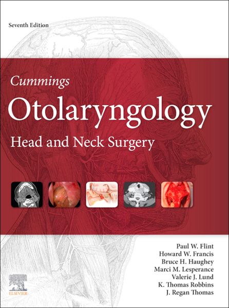 Produktbild: Cummings Otolaryngology E-Book