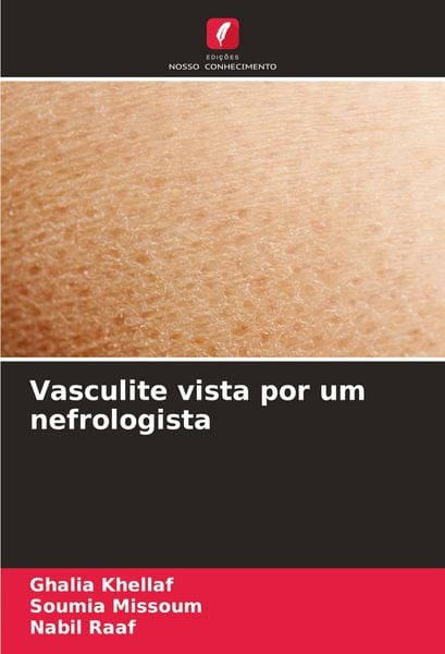 Produktbild: Vasculite vista por um nefrologista